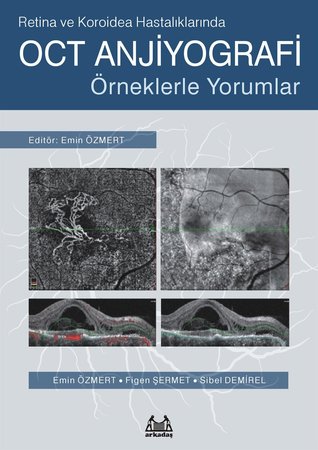 Retina ve Koroidea Hastalıklarında OCT Anjiyografi - Örneklerle Yorumlar