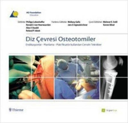 Diz Çevresi Osteotomiler Endikasyonlar Planlama Plas Fiksatör Kullanılan Cerrahi Teknikler